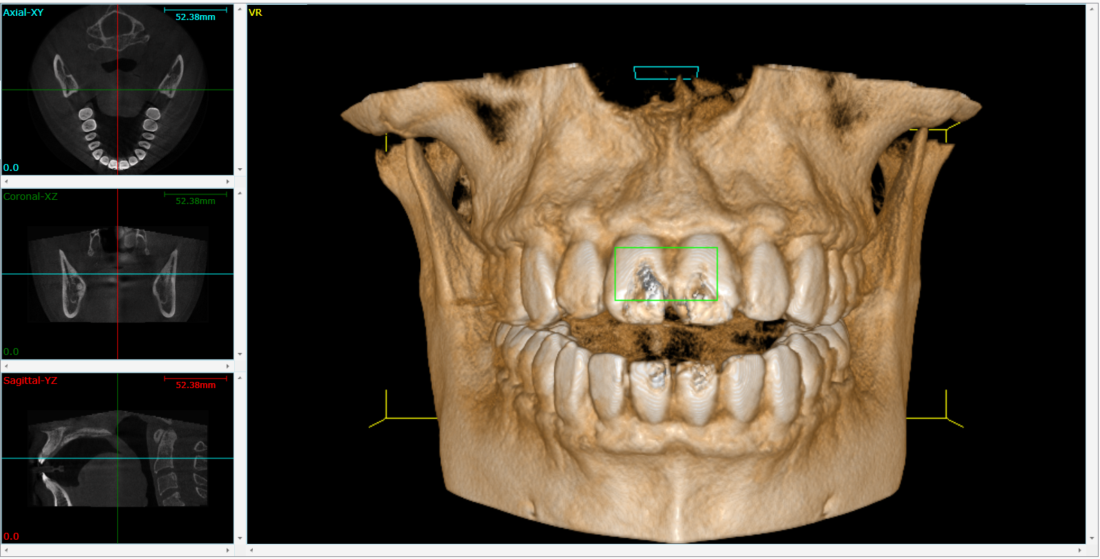 Cone Beam 3D Imaging Livermore, CA