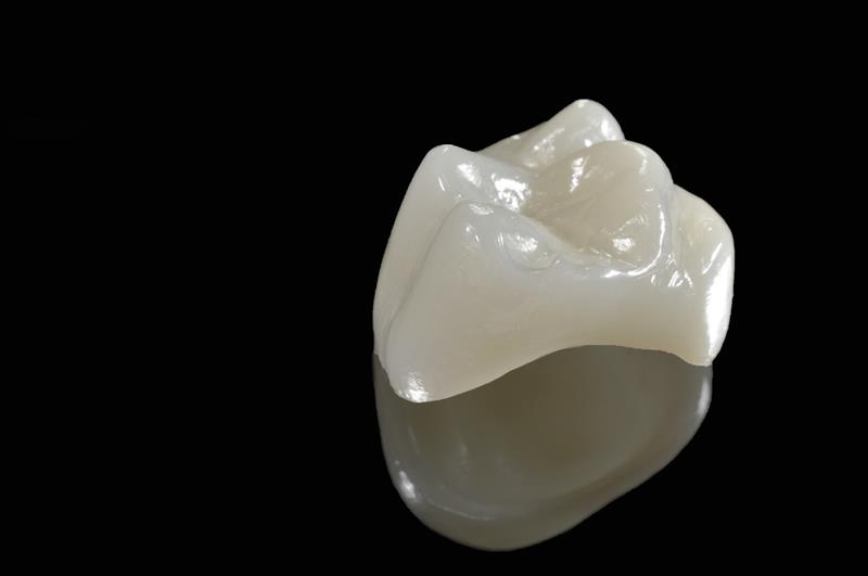 Porcelain Crowns Livermore, CA